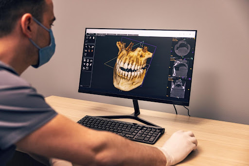 Best CAD Dental Designer